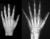Radiografia del polso e della mano sinistra per lo studio dellEt Ossea
